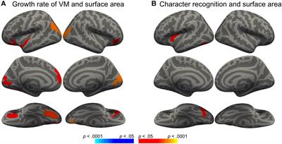 Shared Neural Substrates Underlying Reading and Visual Matching: A Longitudinal Investigation